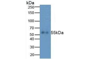 Rabbit Capture antibody from the kit in WB with Positive Control:  HepG2 cell lysate. (Caspase 8 ELISA 试剂盒)
