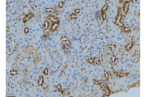 ABIN6272874 at 1/100 staining Mouse kidney tissue by IHC-P. (BBS5 抗体  (C-Term))