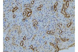 ABIN6272874 at 1/100 staining Mouse kidney tissue by IHC-P.