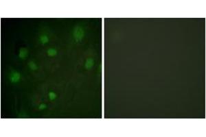 Immunofluorescence analysis of HeLa cells, using IGF2R (Ab-2484) Antibody. (IGF2R 抗体  (AA 2441-2490))
