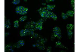 Image no. 3 for anti-Proteasome (Prosome, Macropain) 26S Subunit, ATPase, 3 (PSMC3) antibody (ABIN1501335) (PSMC3 抗体)