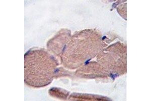 IHC analysis of FFPE human skeletal muscle tissue stained with Myostatin antibody (MSTN 抗体  (AA 9-38))