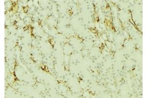 ABIN6277296 at 1/100 staining Mouse kidney tissue by IHC-P. (Dynamin 1-Like 抗体  (C-Term))