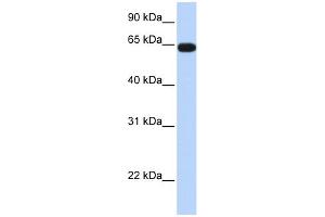 WB Suggested Anti-C16orf44 Antibody Titration:  0. (KLHL36 抗体  (Middle Region))