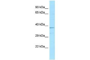 Western Blotting (WB) image for anti-ATPase, H+ Transporting, Lysosomal 38kDa, V0 Subunit D1 (ATP6V0D1) (C-Term) antibody (ABIN2790459)