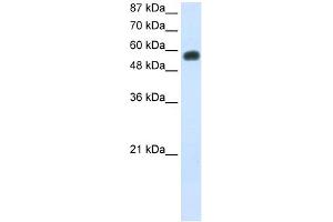 WB Suggested Anti-NOC4L Antibody Titration:  0. (NOC4L 抗体  (C-Term))