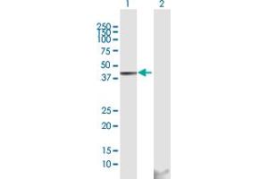 Western Blotting (WB) image for anti-Glutamic-Oxaloacetic Transaminase 1, Soluble (Aspartate Aminotransferase 1) (GOT1) (AA 1-413) antibody (ABIN516133)