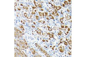 Immunohistochemistry (IHC) image for anti-Eukaryotic Translation Elongation Factor 1 alpha 1 (EEF1A1) (AA 123-462) antibody (ABIN7267022)