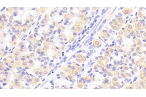 Detection of IL1RA in Human Stomach Tissue using Polyclonal Antibody to Interleukin 1 Receptor Antagonist (IL1RA) (IL1RN 抗体  (AA 26-177))