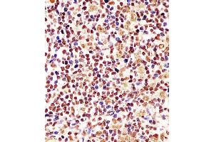 D staining Cyclin D1 in human tonsil tissue sections by Immunohistochemistry (IHC-P - paraformaldehyde-fixed, paraffin-embedded sections). (Cyclin D1 抗体  (AA 68-97))