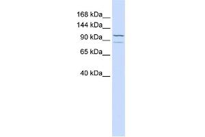 WB Suggested Anti-ADCY6 Antibody Titration:  0. (ADCY6 抗体  (C-Term))