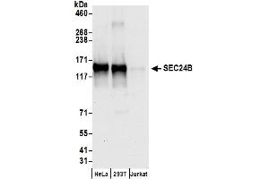 anti-SEC24 Family, Member B (SEC24B) (AA 300-350) antibody