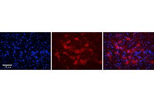 Rabbit Anti-DCAF11 Antibody      Formalin Fixed Paraffin Embedded Tissue: Human Adult Liver   Observed Staining: Cytoplasm in hepatocytes, strong signal, moderate tissue distribution  Primary Antibody Concentration: 1:100  Secondary Antibody: Donkey anti-Rabbit-Cy3  Secondary Antibody Concentration: 1:200  Magnification: 20X  Exposure Time: 0. (DCAF11 抗体  (N-Term))