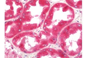 Immunohistochemistry (Paraffin-embedded Sections) (IHC (p)) image for anti-Eukaryotic Translation Elongation Factor 1 delta (Guanine Nucleotide Exchange Protein) (EEF1D) antibody (Biotin) (ABIN2599545)