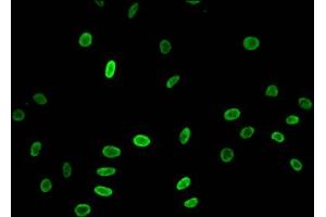 Immunofluorescent analysis of Hela cells treated with NaB using ABIN7139173 at dilution of 1:100 and Alexa Fluor 488-congugated AffiniPure Goat Anti-Rabbit IgG(H+L) (HIST1H3A 抗体  (acLys23))