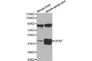 Western Blotting (WB) image for anti-Glial Fibrillary Acidic Protein (GFAP) (C-Term) antibody (ABIN6213705) (GFAP 抗体  (C-Term))