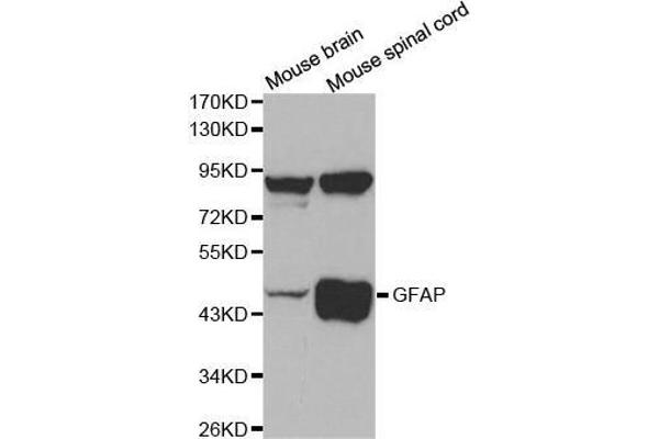 GFAP 抗体  (C-Term)