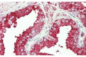 Immunohistochemistry (IHC) image for anti-Carnitine Palmitoyltransferase 1A (Liver) (CPT1A) (AA 191-353) antibody (ABIN7436006)