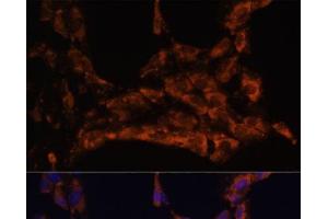 Immunofluorescence analysis of C6 cells using IL18 Polyclonal Antibody at dilution of 1:100. (IL-18 抗体)