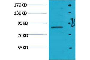 Western Blotting (WB) image for anti-Signal Transducer and Activator of Transcription 5A (STAT5A) antibody (ABIN3179114) (STAT5A 抗体)