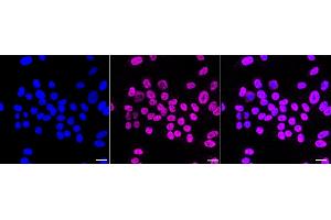 Immunocytochemical staining of HepG2 cells with Forkhead box A1 antibody (ABIN7798641), 1:1,000).