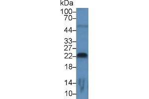 Detection of FGF13 in Rat Cerebrum lysate using Monoclonal Antibody to Fibroblast Growth Factor 13 (FGF13) (FGF13 抗体  (AA 108-227))