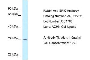 WB Suggested Anti-SPIC Antibody   Titration: 1. (SPIC 抗体  (C-Term))