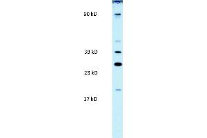 WB Suggested Anti-PAntibody Titration:  0. (PARP11 抗体  (N-Term))