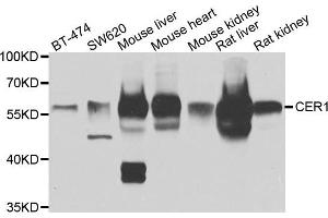 Western blot analysis of extracts of various cell lines, using CER1 antibody. (CER1 抗体)