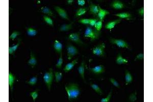Immunofluorescence staining of U251 cells with ABIN7152751 at 1:200, counter-stained with DAPI. (Fibrillin 1 抗体  (AA 783-850))
