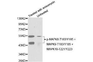Western blot analysis of extracts from C6 cells untreated or treated with anisomycin using Phospho-MAPK8-T183/Y185 + MAPK9-T183/Y185 + MAPK10-T221/Y223 Antibody (ABIN2987800). (MAPK8/9/10 抗体  (pThr183, pThr221, pTyr185))
