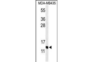 Western blot analysis of GNRH2 Antibody in MDA-MB435 cell line lysates (35ug/lane)