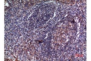 Immunohistochemistry (IHC) image for anti-Interleukin 28 (IL28) (C-Term) antibody (ABIN3181017)