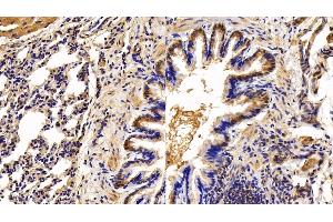 Immunohistochemistry (IHC) image for anti-Angiopoietin-Like 4 (ANGPTL4) (AA 182-394) antibody (ABIN7433021)