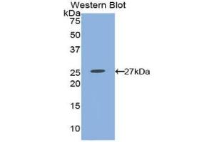 Western blot analysis of the recombinant protein. (PTGER2 抗体  (AA 155-355))