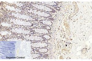 Immunohistochemical analysis of paraffin-embedded human colon tissue. (Caspase 3 p17 (AA 100-180), (Cleaved-Asp175) 抗体)