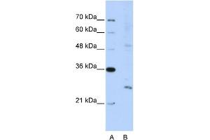 WB Suggested Anti-EXOSC4 Antibody Titration:  5. (EXOSC4 抗体  (N-Term))