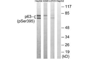 Western blot analysis of extracts from HepG2 cells, A549 cells and LOVO cells all treated with nocodazole (1 μg/mL, 18hours), using p63 (Phospho-Ser395) antibody. (p63 抗体  (pSer395))