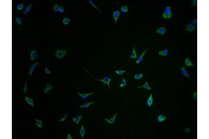 Immunofluorescence staining of SH-SY5Y cells with ABIN7168758-IF at 1:100, counter-stained with DAPI. (SEZ6 抗体  (AA 20-267))
