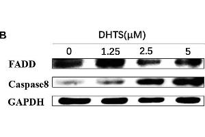 Apoptosis related proteins were detected in EOMA cells after treated with DHTS and propranolol. (FADD 抗体  (AA 1-208))