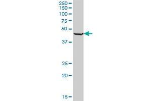 RING1 monoclonal antibody (M03), clone 2B3. (RING1 抗体  (AA 81-170))