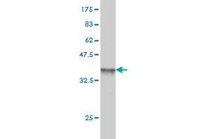 Western Blotting (WB) image for anti-Plasminogen Activator Inhibitor 1 (SERPINE1) (AA 86-185) antibody (ABIN562099)