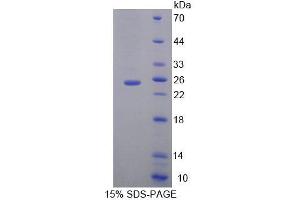 SDS-PAGE analysis of Mouse MOCS1 Protein. (MOCS1 蛋白)
