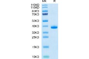 Mouse EGF on Tris-Bis PAGE under reduced condition. (EGF Protein (AA 977-1029) (Fc Tag))