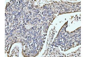 IHC analysis of MOV10 using anti-MOV10 antibody (ABIN7600236). (MOV10 抗体  (AA 167-772))