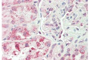Rabbit Anti-RPN1 antibody  Formalin Fixed Paraffin Embedded Tissue: Human Kidney Primary antibody Concentration: 1:100 Secondary Antibody: Donkey anti-Rabbit-Cy3 Secondary Antibody Concentration: 1:200 Magnification: 20x Exposure Time: 0. (RPN1 抗体  (Middle Region))