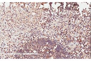 ABIN570765 (2µg/ml) staining of paraffin embedded Human Lymph Node. (ICOS 抗体  (Internal Region))