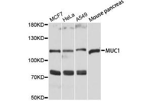 Western blot analysis of extracts of various cell lines, using MUC1 antibody. (MUC1 抗体)