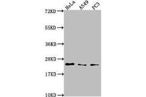 Western Blot Positive WB detected in: Hela whole cell lysate, A549 whole cell lysate, PC3 whole cell lysate All lanes: PEBP1 antibody at 1:2000 Secondary Goat polyclonal to rabbit IgG at 1/50000 dilution Predicted band size: 22 kDa Observed band size: 22 kDa (PEBP1 抗体  (AA 97-128))