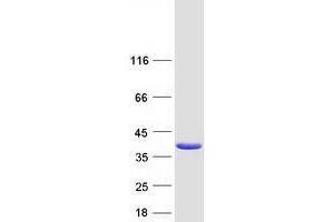 Tumor Protein P53 Inducible Protein 3 (TP53I3) (Transcript Variant 2) protein (Myc-DYKDDDDK Tag)